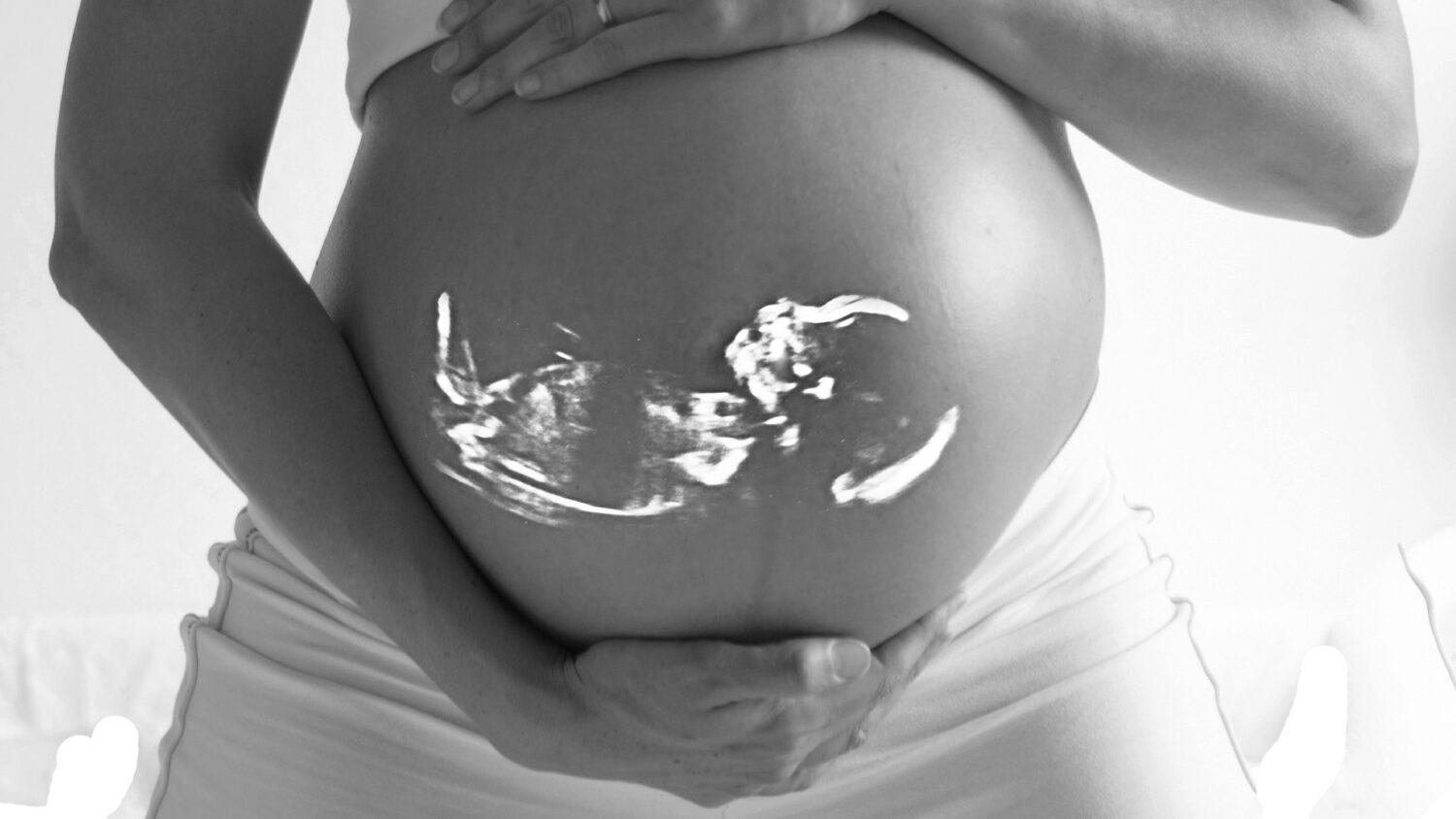 Krotitelia mýtov (7): Ak žena ide na potrat, lebo má rizikové, nie je to hriech – dieťa je šťastné a hneď je anjelikom