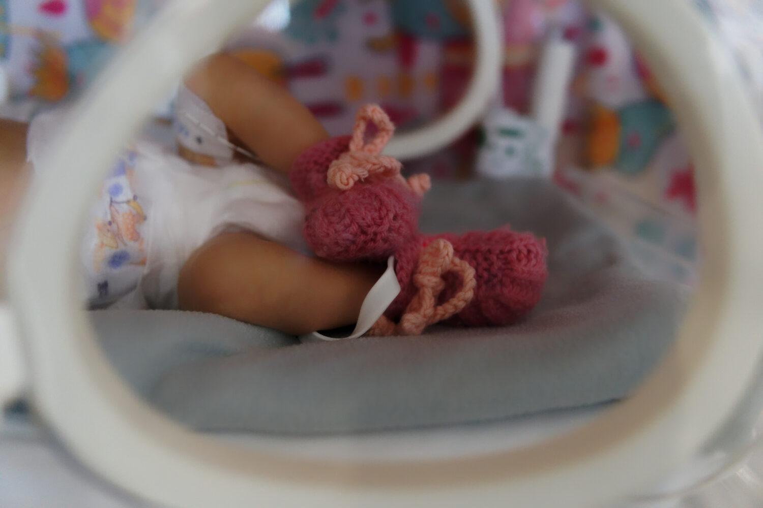 Zrod krehkého života: Nádej je vždy, no niekedy je pre rodinu lepšie nechať dieťa prirodzene odísť