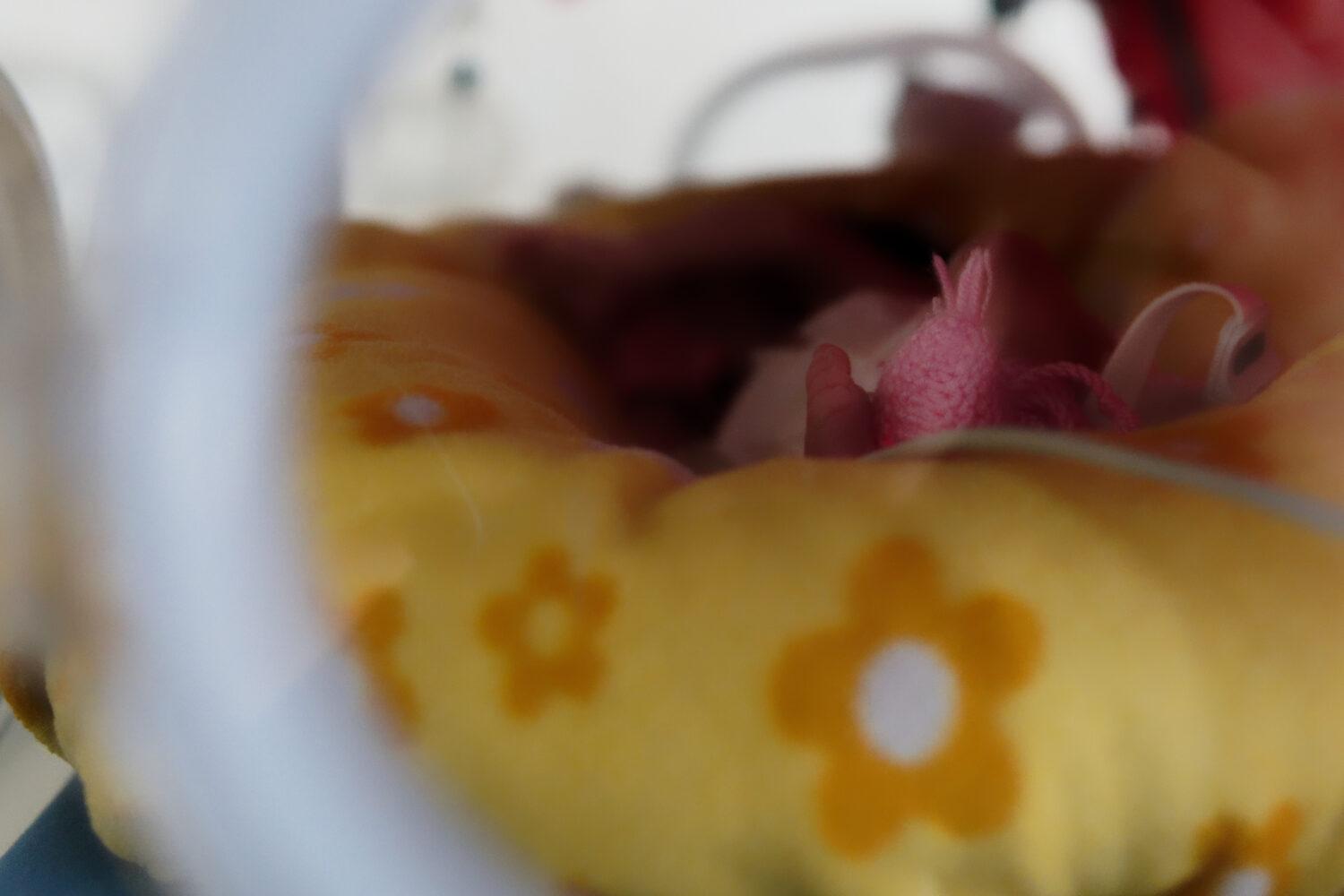 Zrod krehkého života: Nádej je vždy, no niekedy je pre rodinu lepšie nechať dieťa prirodzene odísť